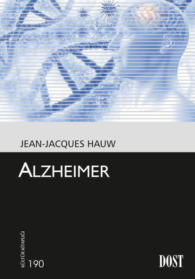 Alzheimer resmi