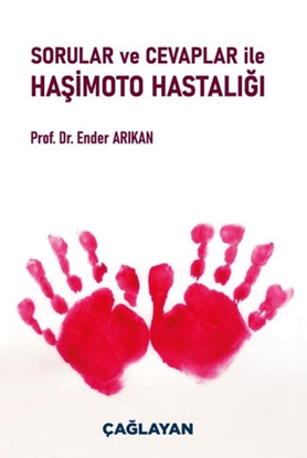 Sorular ve Cevaplar ile Haşimoto Hastalığı resmi